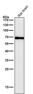 Anti-Cytokeratin 1 Rabbit Monoclonal Antibody Boster Bio