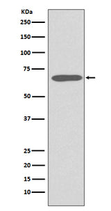 Anti-Cytokeratin 1 Rabbit Monoclonal Antibody Boster Bio