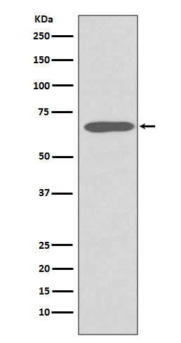 Anti-Cytokeratin 1 Rabbit Monoclonal Antibody Boster Bio