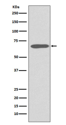 Anti-Cytokeratin 1 Rabbit Monoclonal Antibody Boster Bio