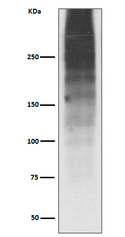 Anti-MUC16/Ca125 Rabbit Monoclonal Antibody Boster Bio