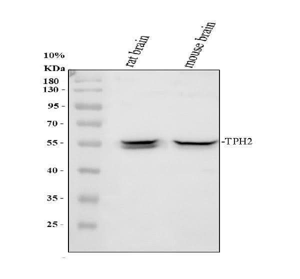 Anti-TPH2 Rabbit Monoclonal Antibody Boster Bio