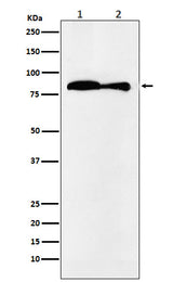 Anti-VPS35 Monoclonal Antibody Boster Bio