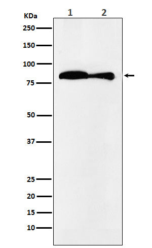 Anti-VPS35 Monoclonal Antibody Boster Bio