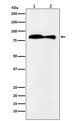 Anti-VPS35 Monoclonal Antibody Boster Bio