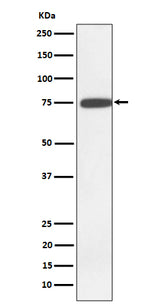 Anti-GNE Rabbit Monoclonal Antibody Boster Bio