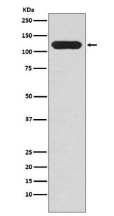 Anti-MUC4 Rabbit Monoclonal Antibody Boster Bio