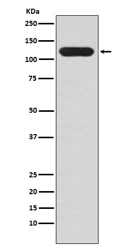 Anti-MUC4 Rabbit Monoclonal Antibody Boster Bio