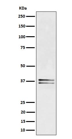 Anti-LAT Rabbit Monoclonal Antibody Boster Bio