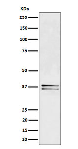 Anti-LAT Rabbit Monoclonal Antibody Boster Bio