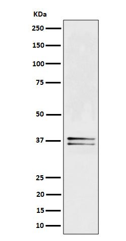 Anti-LAT Rabbit Monoclonal Antibody Boster Bio