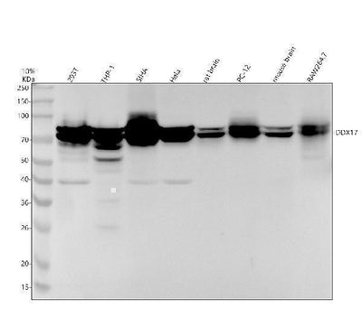 Anti-DDX17 Rabbit Monoclonal Antibody Boster Bio