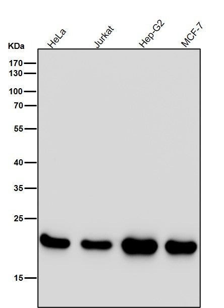 Anti-PEBP1/Pbp Rabbit Monoclonal Antibody Boster Bio