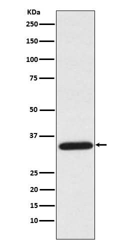 Anti-UNG Rabbit Monoclonal Antibody Boster Bio