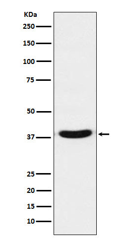 Anti-TRBP Monoclonal Antibody Boster Bio