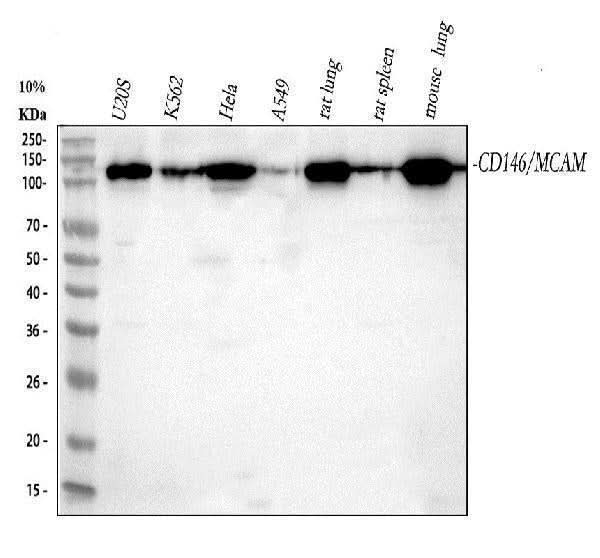 Anti-CD146 MCAM Rabbit Monoclonal Antibody Boster Bio