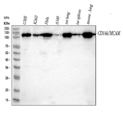 Anti-CD146 MCAM Rabbit Monoclonal Antibody Boster Bio