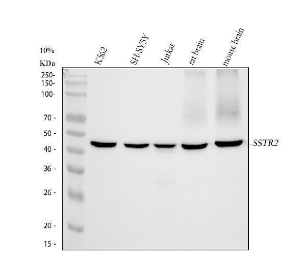 Anti-Somatostatin Receptor 2 SSTR2 Rabbit Monoclonal Antibody Boster Bio