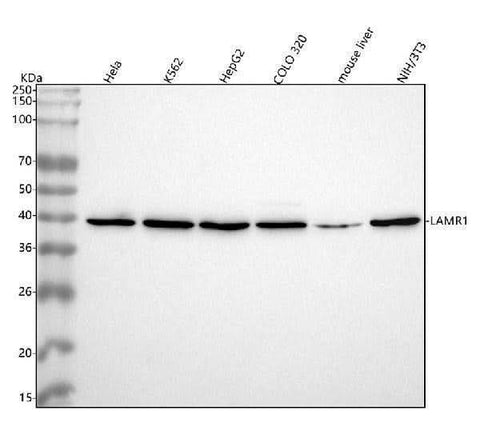 Anti-67kDa Laminin Receptor RPSA Rabbit Monoclonal Antibody Boster Bio