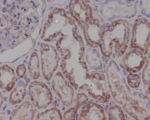 Anti-Hsp90 beta HSP90AB1 Rabbit Monoclonal Antibody Boster Bio