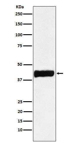 Anti-Creatine kinase B type CKB Monoclonal Antibody Boster Bio