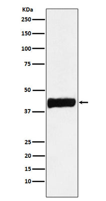 Anti-Creatine kinase B type CKB Monoclonal Antibody Boster Bio