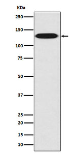 Anti-Myosin light chain kinase MYLK Rabbit Monoclonal Antibody Boster Bio