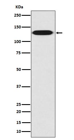 Anti-Myosin light chain kinase MYLK Rabbit Monoclonal Antibody Boster Bio