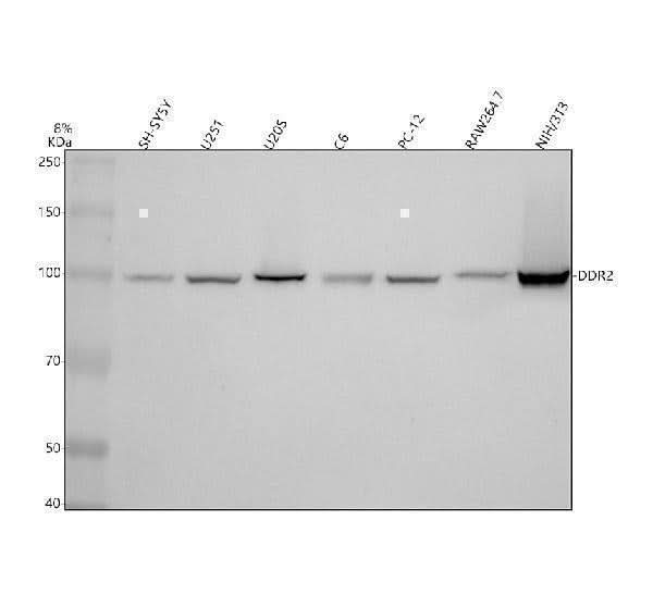 Anti-DDR2 Monoclonal Antibody Boster Bio