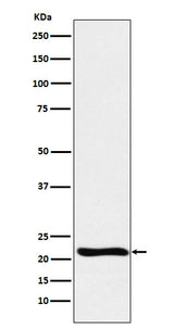 Anti-GLO1 Monoclonal Antibody Boster Bio