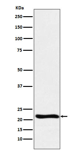 Anti-GLO1 Monoclonal Antibody Boster Bio