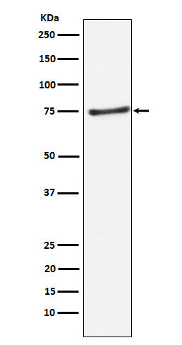 Anti-PIAS1 Rabbit Monoclonal Antibody Boster Bio