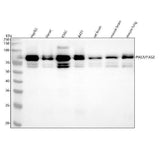 Anti-PIAS1+PIAS2+PIAS3 Rabbit Monoclonal Antibody Boster Bio