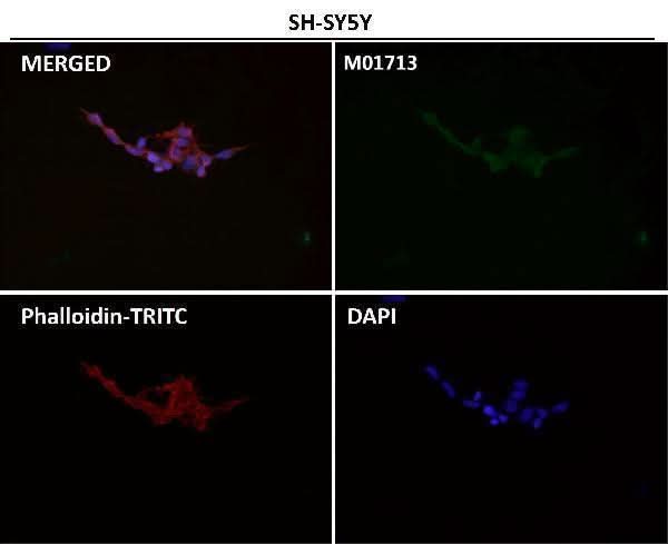 Anti-EAAT2/GLT-1/SLC1A2 Rabbit Monoclonal Antibody Boster Bio