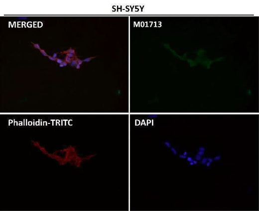 Anti-EAAT2/GLT-1/SLC1A2 Rabbit Monoclonal Antibody Boster Bio