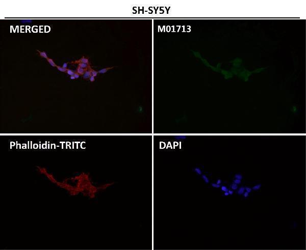 Anti-EAAT2/GLT-1/SLC1A2 Rabbit Monoclonal Antibody Boster Bio