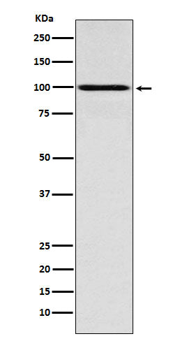 Anti-IFNGR1 Rabbit Monoclonal Antibody Boster Bio