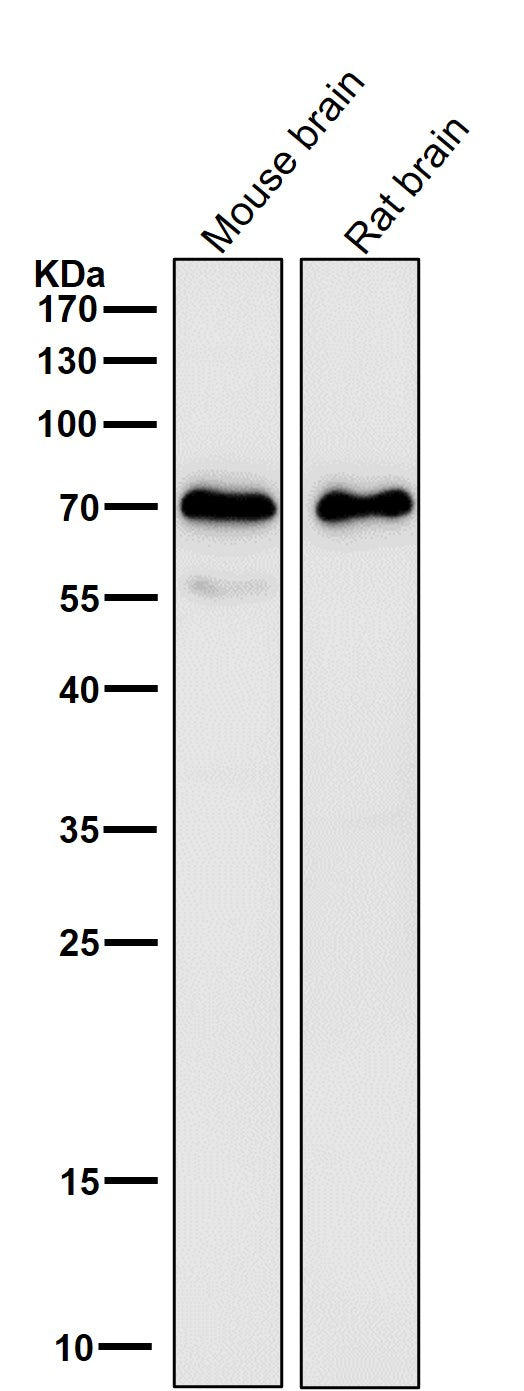 Anti-SAM68 Rabbit Monoclonal Antibody Boster Bio