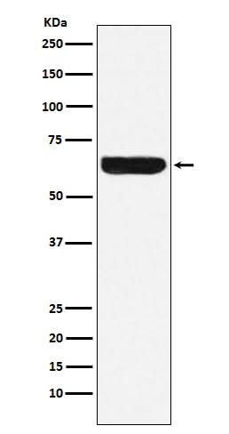 Anti-Placental alkaline phosphatase (PLAP) Rabbit Monoclonal Antibody Boster Bio