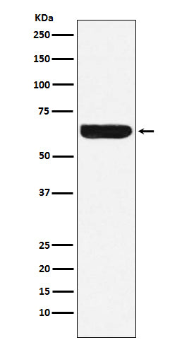 Anti-Placental alkaline phosphatase (PLAP) Rabbit Monoclonal Antibody Boster Bio