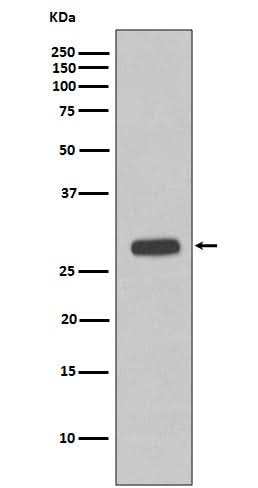 Anti-Troponin I Rabbit Monoclonal Antibody Boster Bio