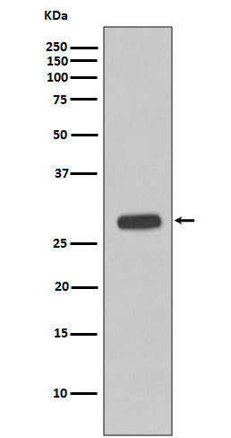 Anti-Troponin I Rabbit Monoclonal Antibody Boster Bio