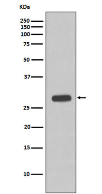 Anti-Troponin I Rabbit Monoclonal Antibody Boster Bio