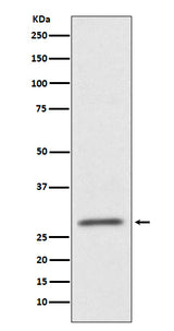 Anti-CD99 Rabbit Monoclonal Antibody Boster Bio