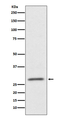 Anti-CD99 Rabbit Monoclonal Antibody Boster Bio