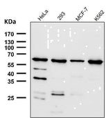 Anti-HRPT2 / CDC73 Rabbit Monoclonal Antibody Boster Bio