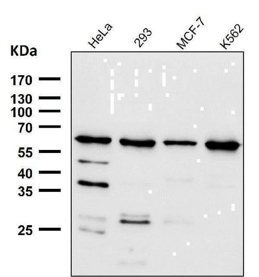 Anti-HRPT2 / CDC73 Rabbit Monoclonal Antibody Boster Bio