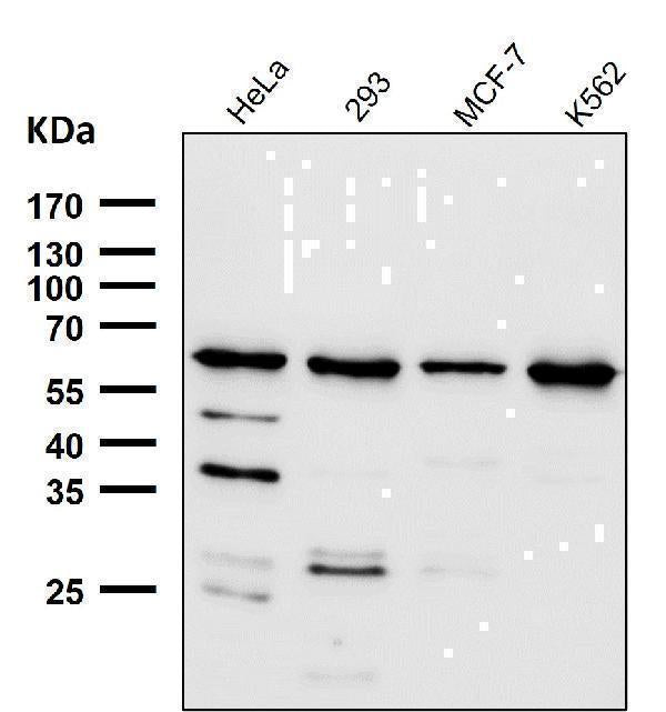 Anti-HRPT2 / CDC73 Rabbit Monoclonal Antibody Boster Bio