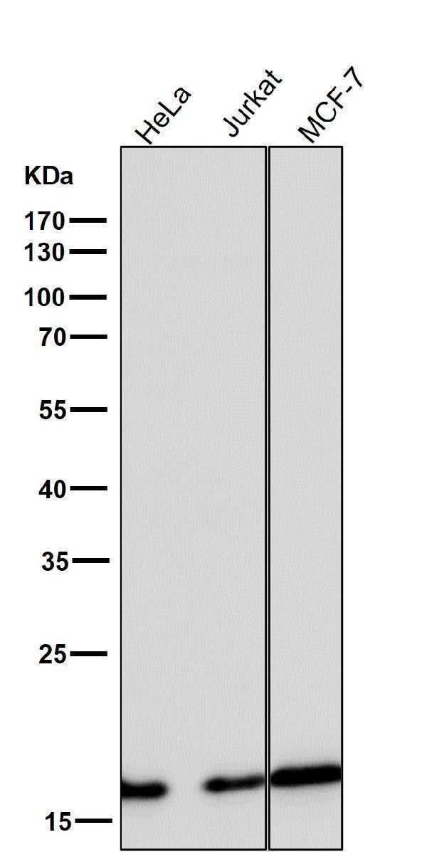 Anti-eIF5A Rabbit Monoclonal Antibody Boster Bio