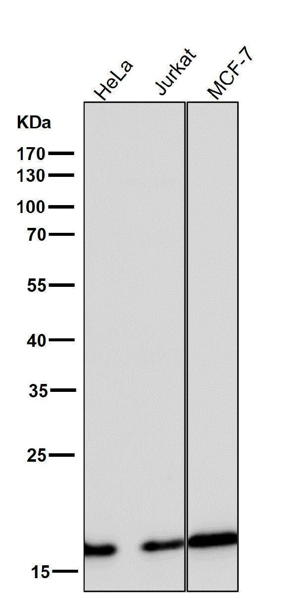 Anti-eIF5A Rabbit Monoclonal Antibody Boster Bio